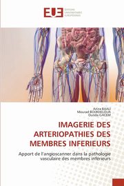 IMAGERIE DES ARTERIOPATHIES DES MEMBRES INFERIEURS, BAALI Aziza