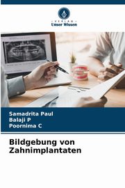 Bildgebung von Zahnimplantaten, Paul Samadrita