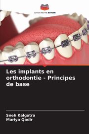 Les implants en orthodontie - Principes de base, Kalgotra Sneh