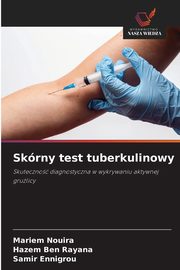 Skrny test tuberkulinowy, Nouira Mariem