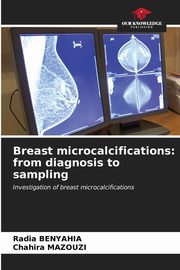 Breast microcalcifications, BENYAHIA Radia