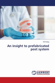 An insight to prefabricated post system, Garg Kriti