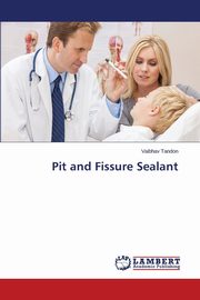 Pit and Fissure Sealant, Tandon Vaibhav