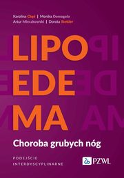 Lipoedema, Ch Karolina, Domagaa Monika, Mieczkowski Artur, Stettler Dorota