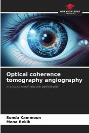 Optical coherence tomography angiography, KAMMOUN Sonda