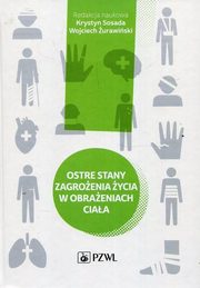 Ostre stany zagroenia ycia w obraeniach ciaa, 