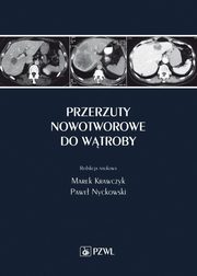 Przerzuty nowotworowe do wtroby, 