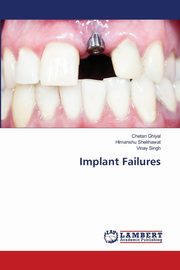 Implant Failures, Ghiyal Chetan