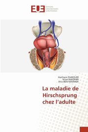 La maladie de Hirschsprung chez l'adulte, ZAAFOURI Haithem