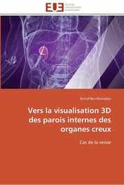 Vers la visualisation 3d des parois internes des organes creux, BEN-HAMADOU-A