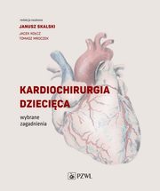 Kardiochirurgia dziecica, 