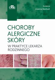 Choroby alergiczne skry w praktyce lekarza rodzinnego, 