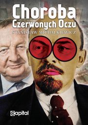 Choroba czerwonych oczu, Michalkiewicz Stanisaw