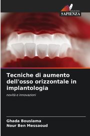 Tecniche di aumento dell'osso orizzontale in implantologia, Bouslama Ghada