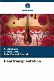 Haartransplantation, Abhilash R.