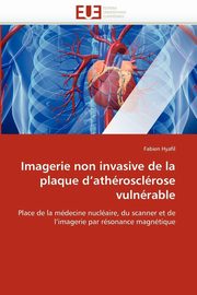 Imagerie non invasive de la plaque d''athrosclrose vulnrable, HYAFIL-F