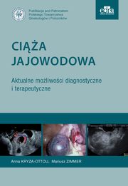 Cia jajowodowa Aktualne moliwoci diagnostyczne i terapeutyczne, Kryza-Ottou A., Zimmer M.