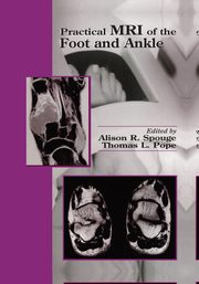 Practical MRI of the Foot and Ankle, 