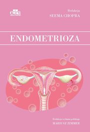 Endometrioza, 
