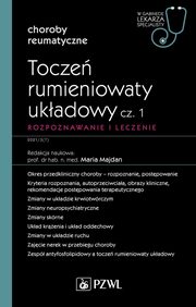 Tocze rumieniowaty ukadowy Cz 1 Rozpoznawanie i leczenie, Majdan Maria