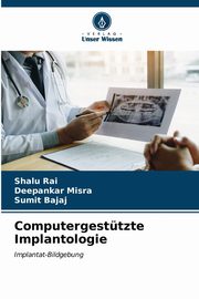 Computergesttzte Implantologie, Rai Shalu