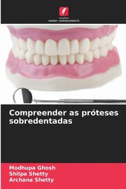 Compreender as prteses sobredentadas, Ghosh Modhupa