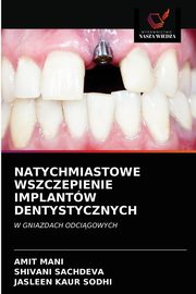 NATYCHMIASTOWE WSZCZEPIENIE IMPLANTW DENTYSTYCZNYCH, MANI AMIT