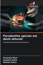 Parodontite apicale nei denti otturati, MORE PRIYANKA