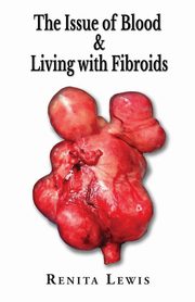 The Issue Of Blood & Living with Fibroids, Lewis Renita