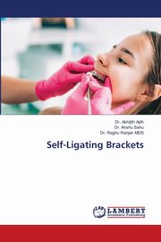 Self-Ligating Brackets, Ajith Dr. Abhijith