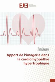 Apport de l'imagerie dans la cardiomyopathie hypertrophique, KAMMOUN-I