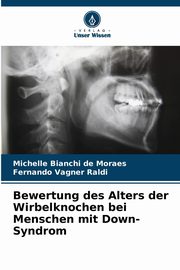 Bewertung des Alters der Wirbelknochen bei Menschen mit Down-Syndrom, Bianchi de Moraes Michelle