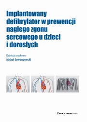 Implantowany defibrylator w prewencji nagego zgonu sercowego u dzieci i dorosych, 