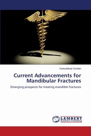 Current Advancements for Mandibular Fractures, Soodan Kanwaldeep