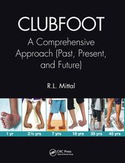 Clubfoot, Mittal R. L.