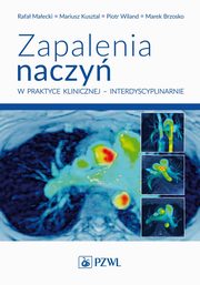 Zapalenia naczy w praktyce klinicznej interdyscyplinarnie, Maecki Rafa, Kusztal Mariusz, Wiland Piotr, Brzosko Marek