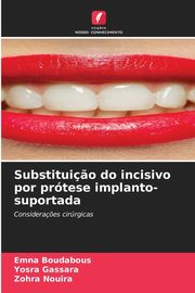 Substitui?o do incisivo por prtese implanto-suportada, Boudabous Emna