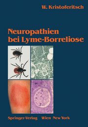 Neuropathien bei Lyme-Borreliose, Kristoferitsch Wolfgang