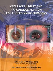 ksiazka tytu: Cataract Surgery And Phacoemulsification For The Beginning Surgeons autor: Huq Dr.S.M.Munirul