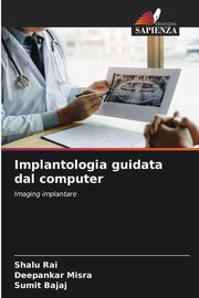 Implantologia guidata dal computer, Rai Shalu