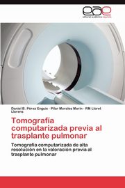 Tomografa computarizada previa al trasplante pulmonar, Prez Enguix Daniel B.