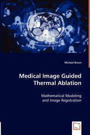 ksiazka tytu: Medical Image Guided Thermal Ablation autor: Breen Michael