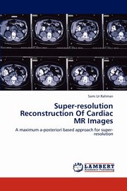 Super-resolution Reconstruction Of Cardiac MR Images, Rahman Sami Ur