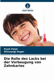 Die Rolle des Lacks bei der Vorbeugung von Zahnkaries, Patel Punit