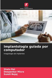 Implantologia guiada por computador, Rai Shalu