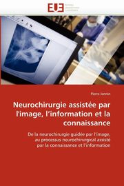 Neurochirurgie assiste par l''image, l''information et la connaissance, JANNIN-P