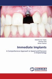 Immediate Implants, Yadav Satishkumar