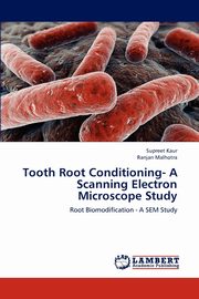 Tooth Root Conditioning- A Scanning Electron Microscope Study, Kaur Supreet