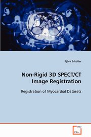 Non-Rigid 3D SPECT/CT Image Registration, Eskofier Bjrn