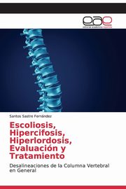 Escoliosis, Hipercifosis, Hiperlordosis, Evaluacin y Tratamiento, Sastre Fernndez Santos